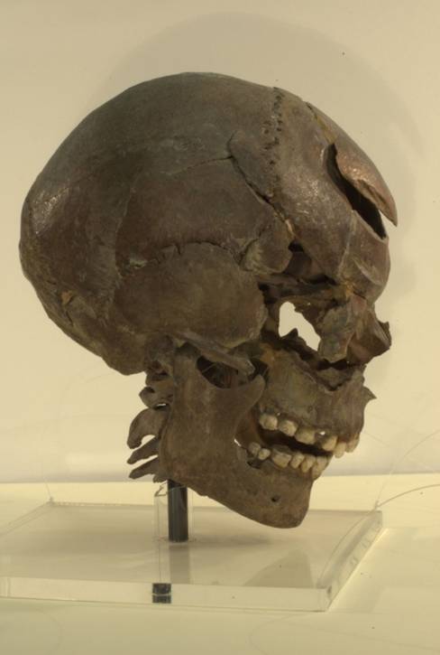 Side of the Skull of Stanwick Man
