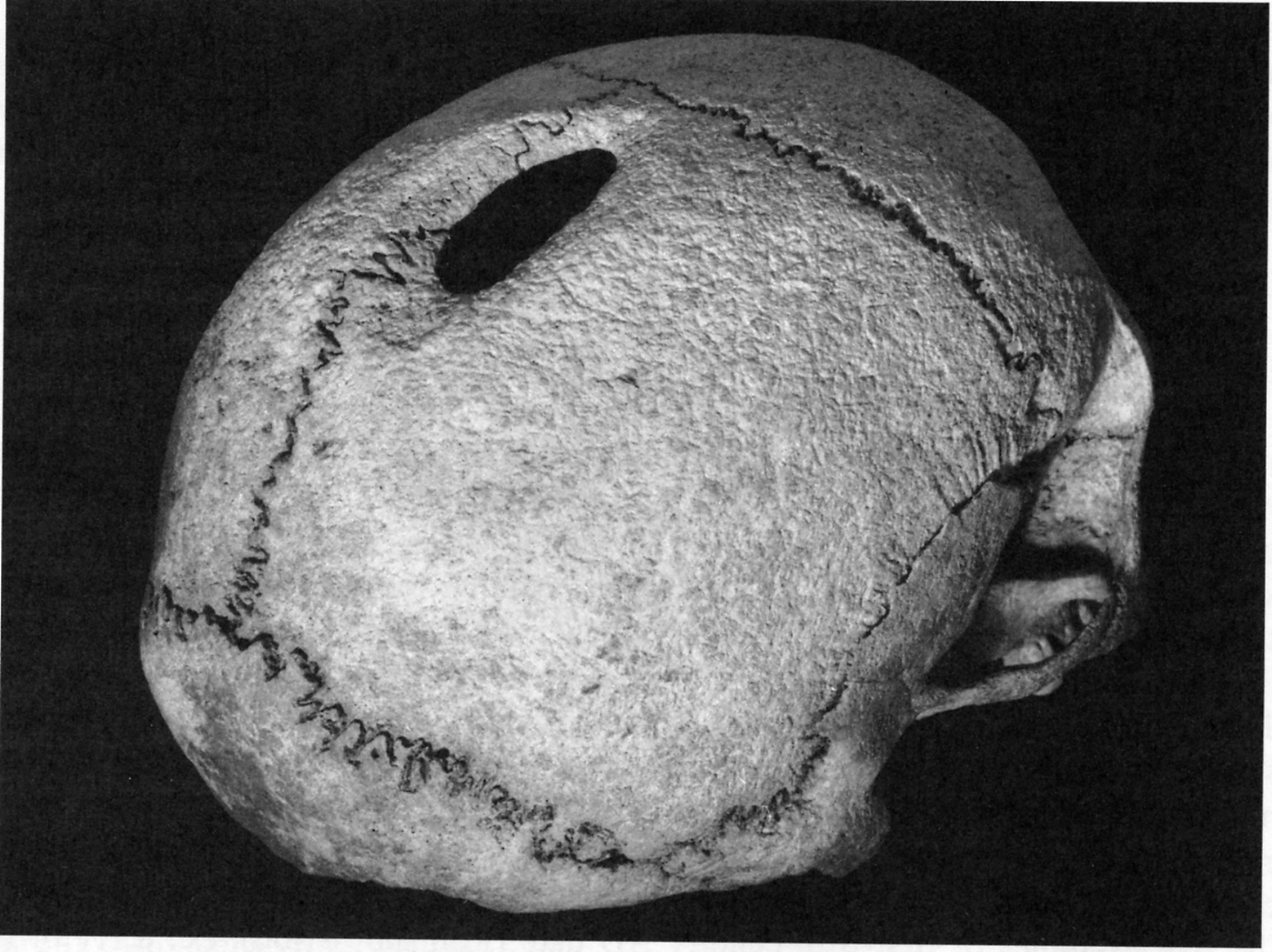 Rear view of the Oxborough Skull
